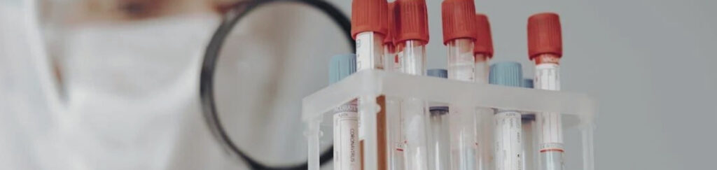 Ağır metal testi kozmetik ürünlerde tüketici güvenliğini sağlamak için gereklidir.