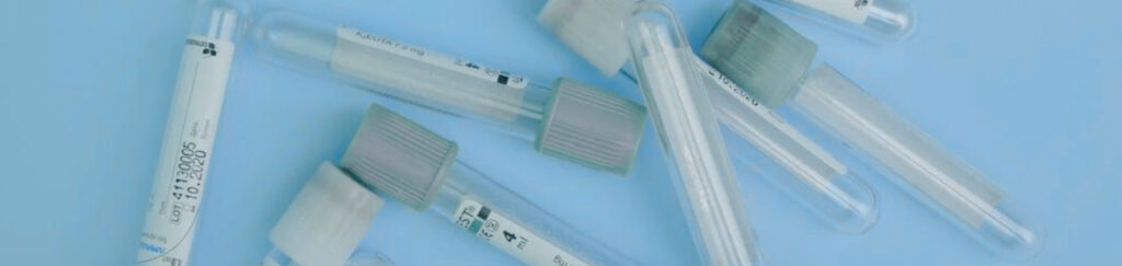 in-vivo-ve-in-vitro-test